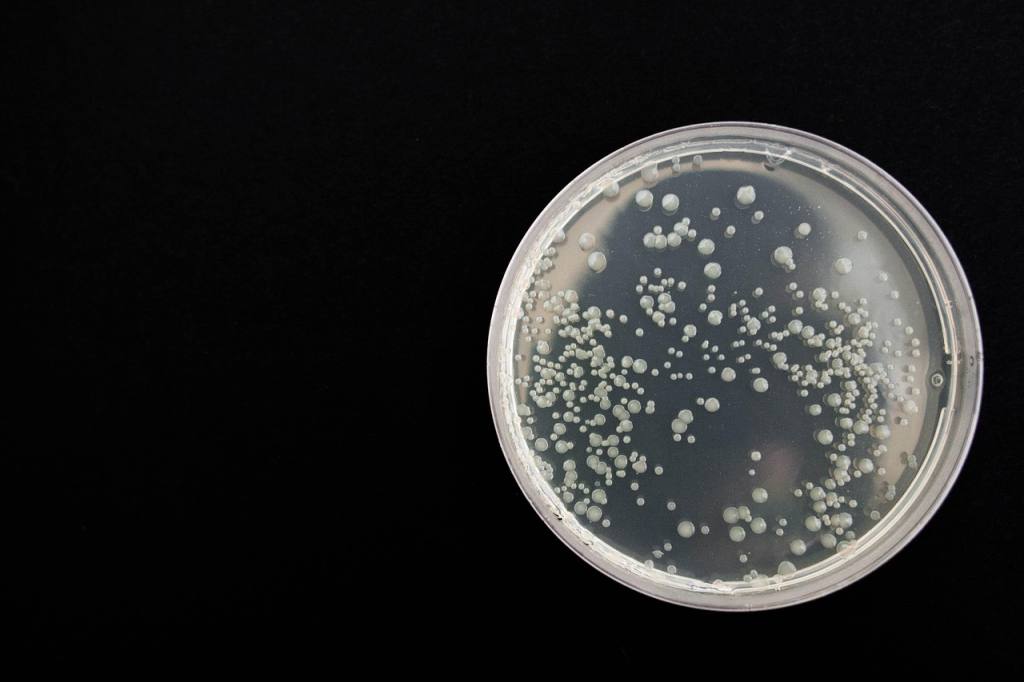 bacteria, black, health, microbiology, infection, cell, biology, dna, experiment, science, laboratory, research, close-up, bacterium, white, medicine, colony, black health, black science, black research, black medicine, black laboratory, black closed, bacteria, bacteria, bacteria, bacteria, bacteria, microbiology, laboratory